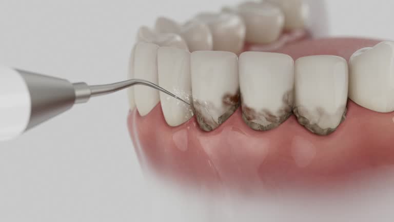 Reliable Dental Implants contractor in Sequatchie County County, TN by Dentist Open Now